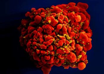 Un estudio europeo dice haber encontrado tratamiento puede prevenir la transmisión  del virus VIH