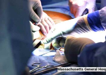 Riñón de cerdo modificado genéticamente trasplantado exitosamente a un paciente en Massachusetts