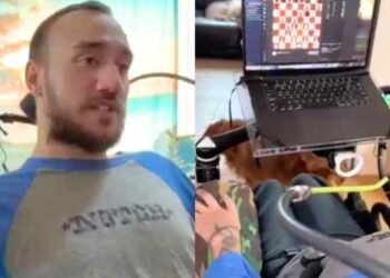 El primer ensayo en humanos de Neuralink genera esperanza y miedo