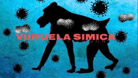 Brote de mpox, viruela símica, se convierte en emergencia de salud pública en África